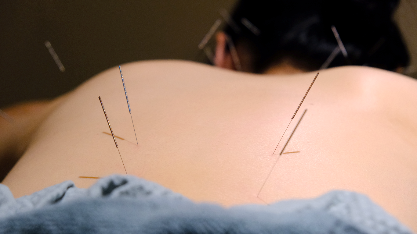 TCM Pain management, relieve pain naturally with TCM