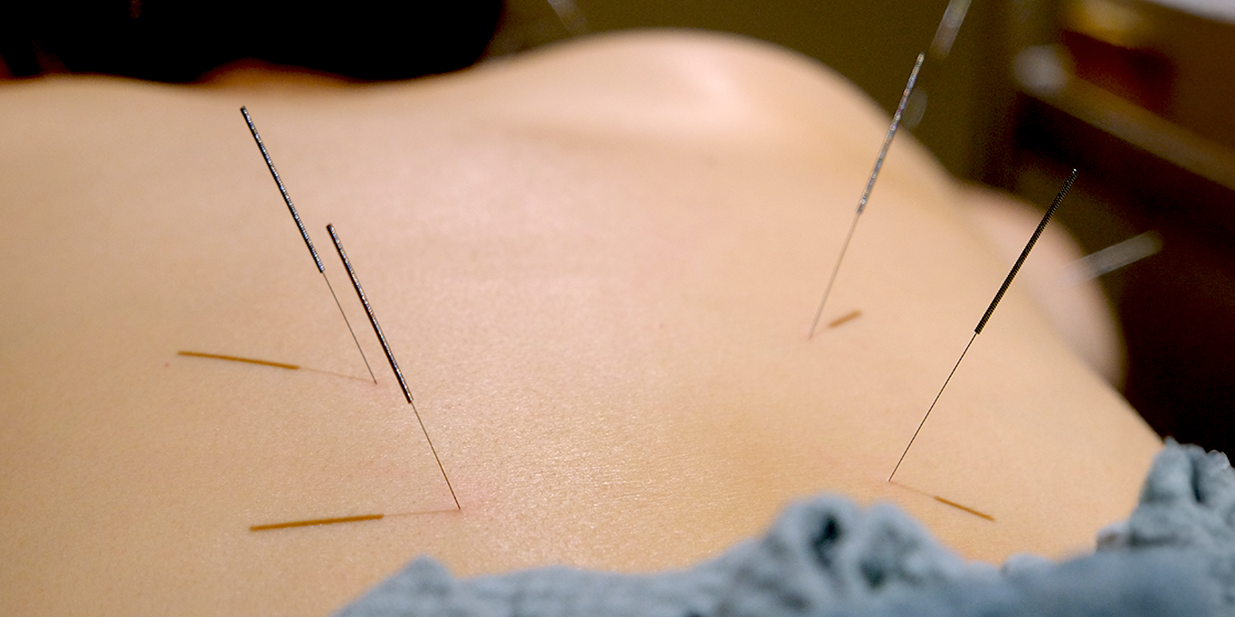 TCM for women Polycystic Ovary Syndrome (PCOS)