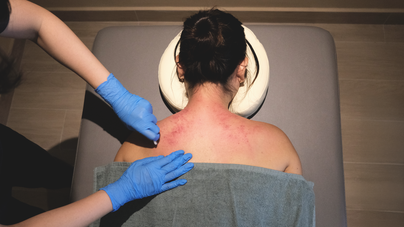 tcm treatments for women's health, acupuncture, herbal medicine, gua sha, cupping, and more
