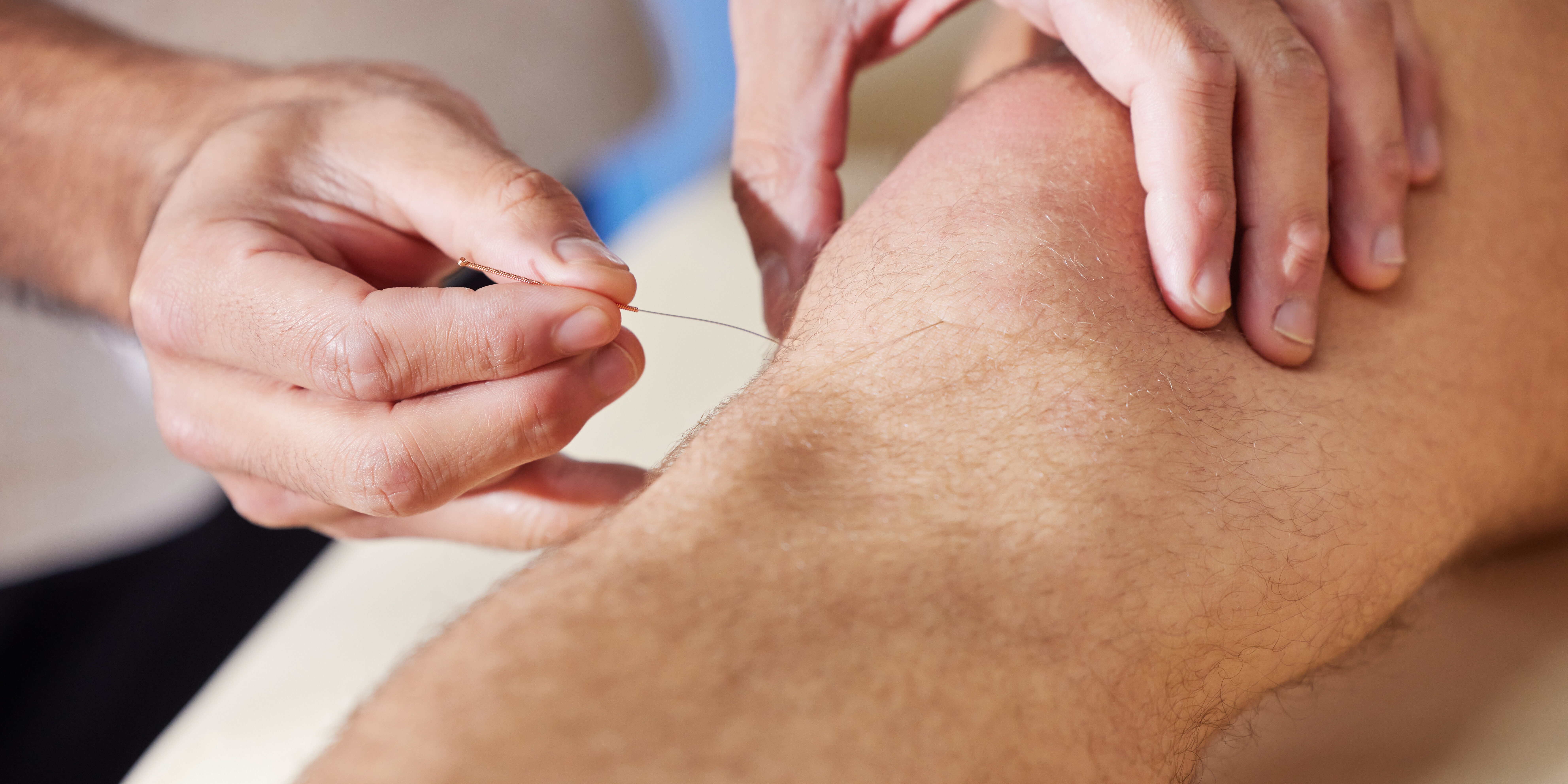 tcm for arthritis - regis wellness tcm clinic
