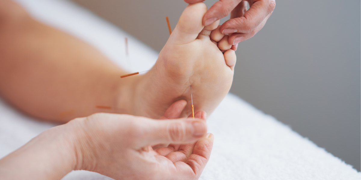TCM for Foot Pain - acupuncture, herbal medicine, cupping, moxibustion, and gua sha