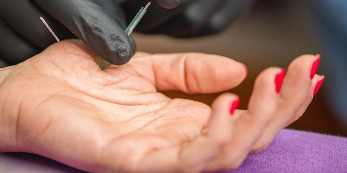 TCM treatments for Wrist Pain in singapore - acupuncture, gua sha, herbal medicine, and more.