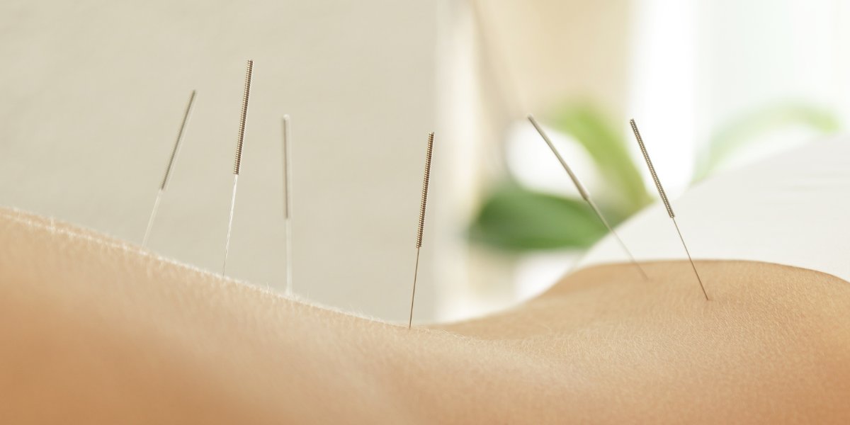 What is TCM Gastric Reflux Management