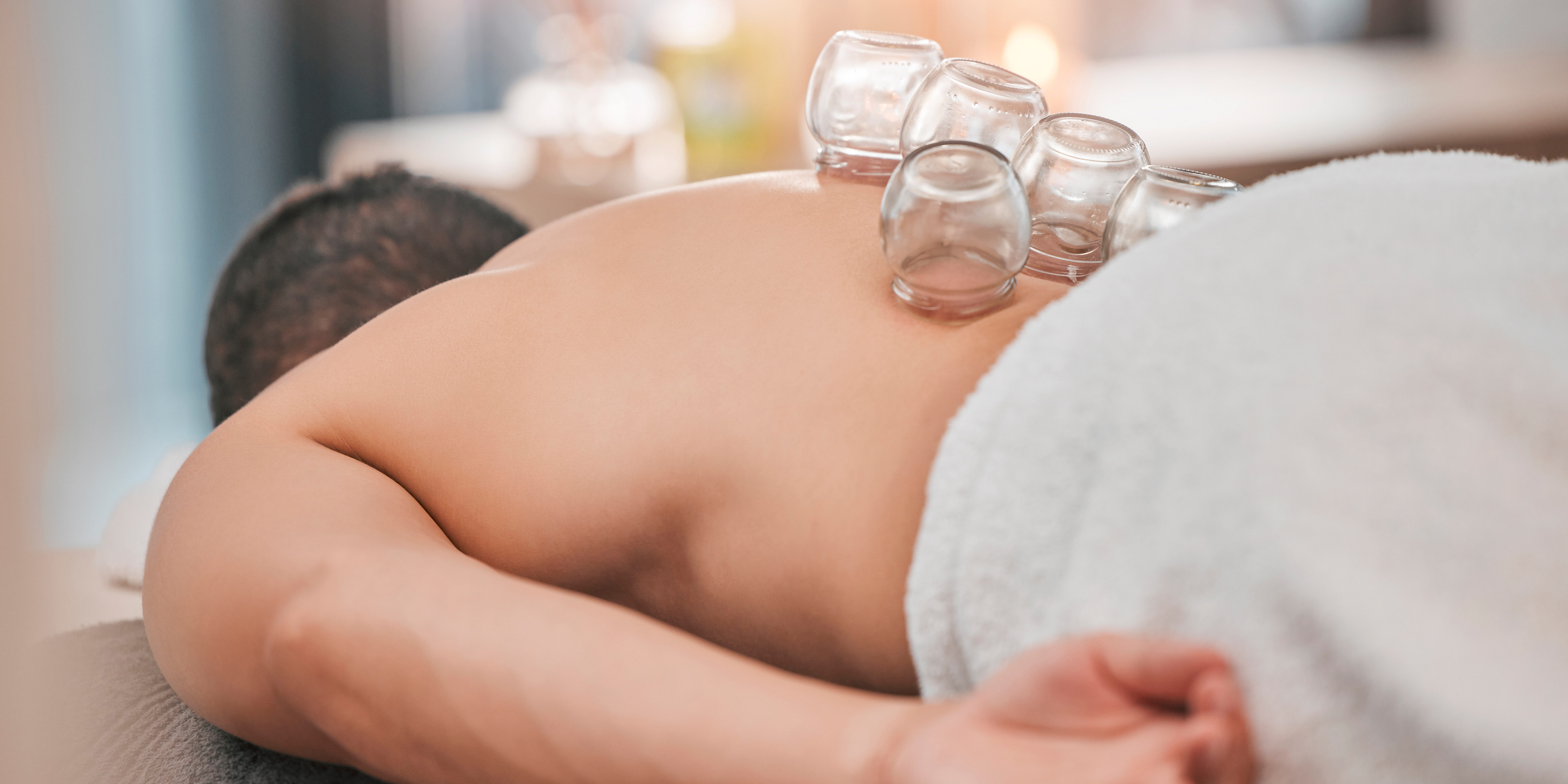 tcm therapies for sports - acupuncture, cupping, moxibustion, herbal medicine, gua sha